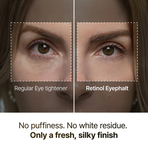 Eyephalt Eyebag Lifting Line