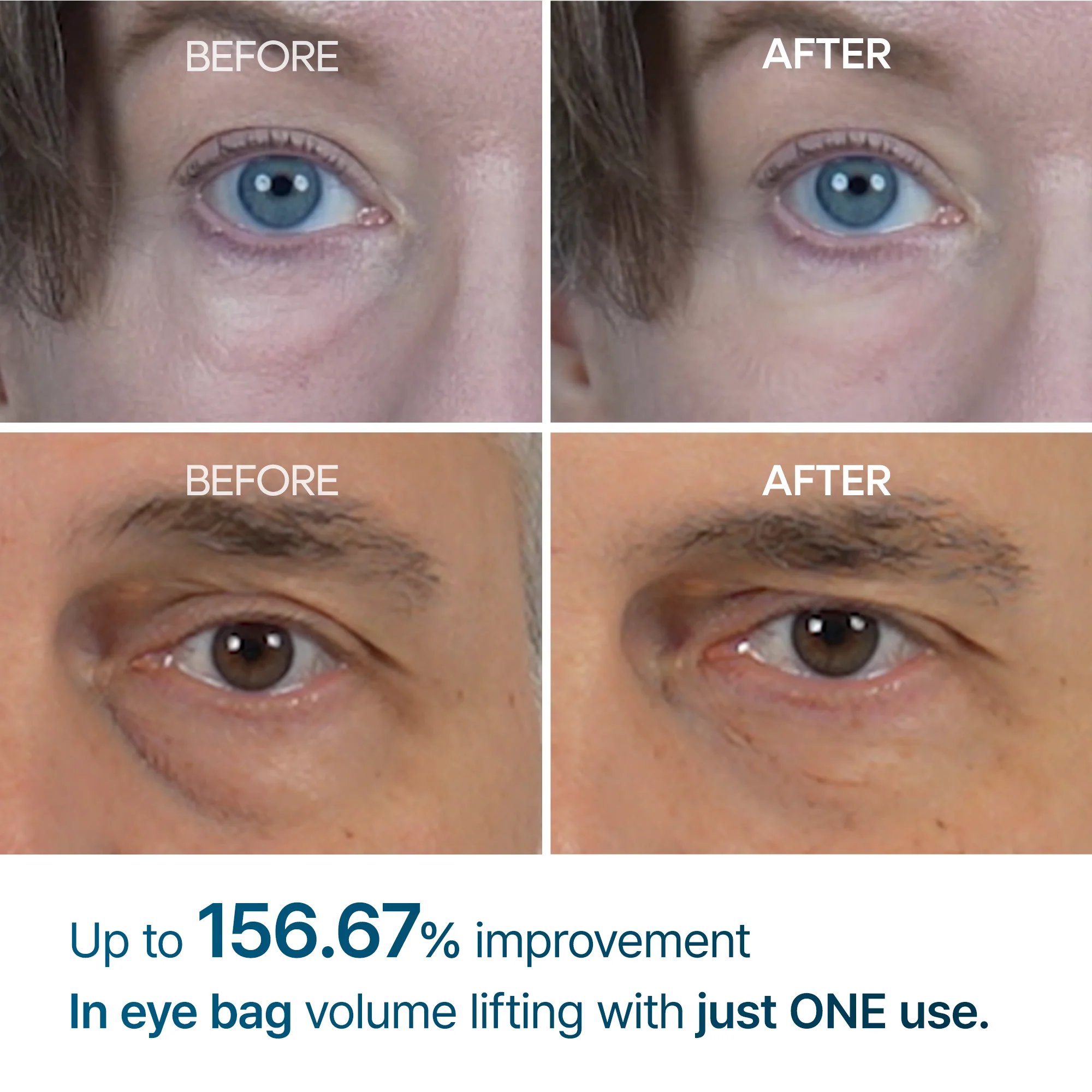 Eyephalt Eyebag Cream - 10g