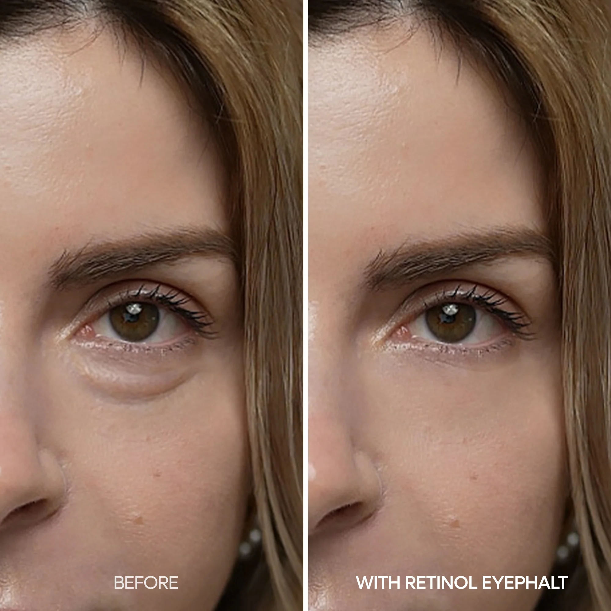 Retinol Eyebag Cream - 10g